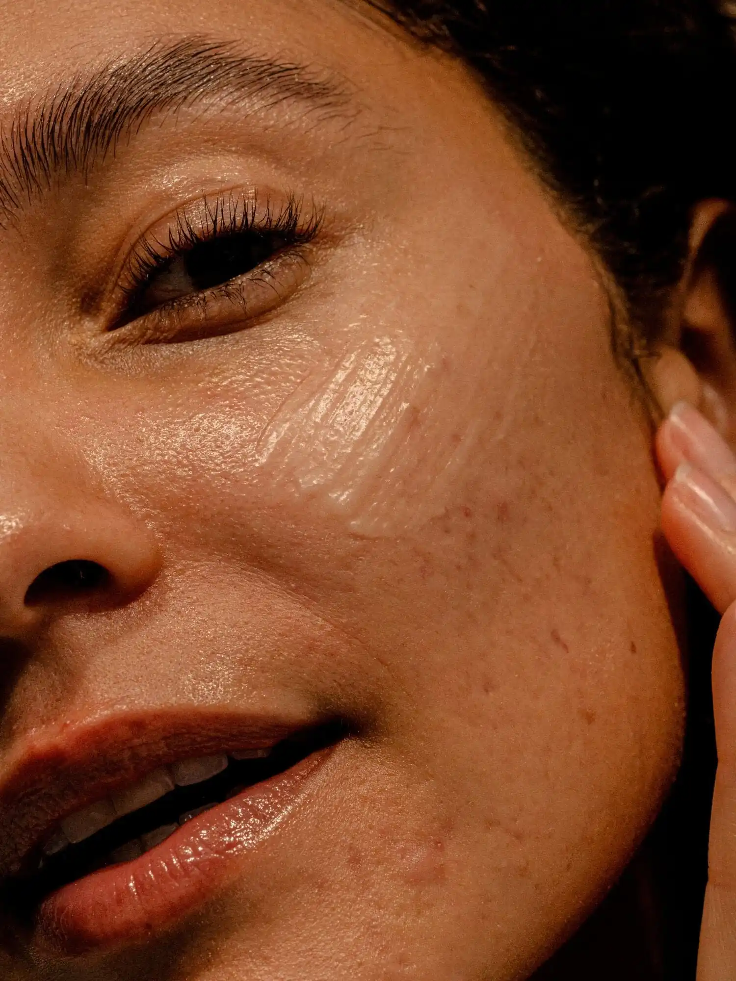 Adult Acne Bundle - Image 3